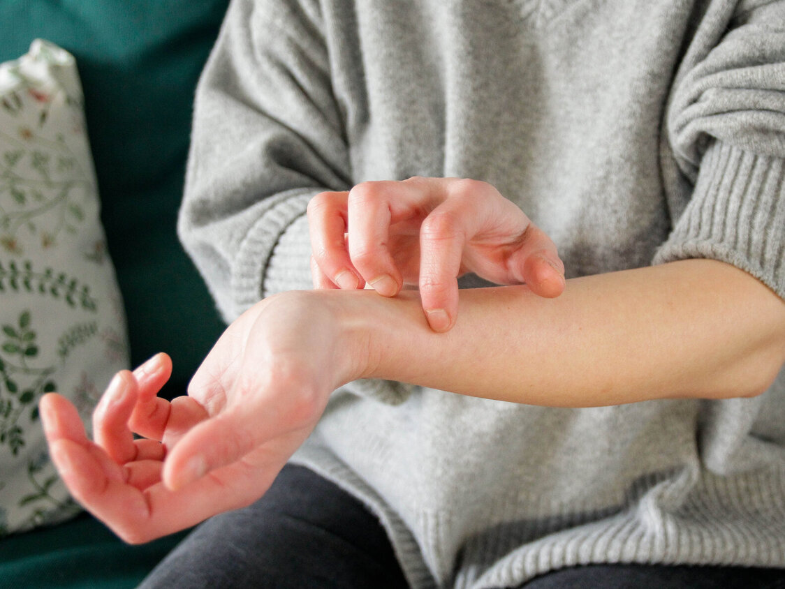 Eine Frau kratzt sich am Unterarm.