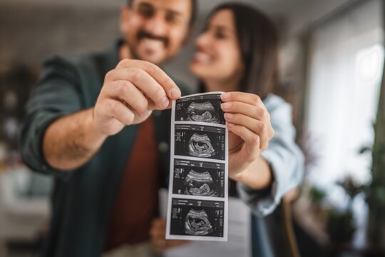 Nahaufnahme eines Paares, die ein Ultraschallbild ihres Babys in den Händen halten.