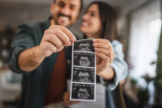 Nahaufnahme eines Paares, die ein Ultraschallbild ihres Babys in den Händen halten.
