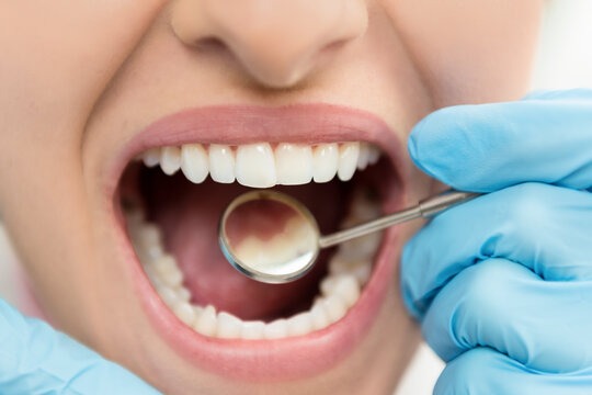 Frau mit geöffnetem Mund beim Zahnarzt.