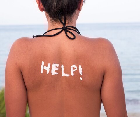 Eine Frau hat Sonnenbrand auf dem Rücken. Mit Sonnencreme wurde "HELP!" auf ihren Rücken geschrieben.