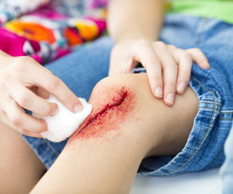 Jemand säubert mit einem Tupfer die blutende Kniewunde eines Kindes.