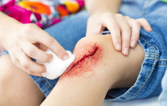Jemand säubert mit einem Tupfer die blutende Kniewunde eines Kindes.