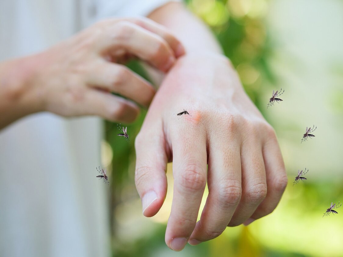 Ein Arm wird von Mücken umkreist, er ist gerötet. Der Andere Arm kratzt ihn.Im Hintergrund ist verschwommen eine grüne Landschaft/ Garten zu erkennen.