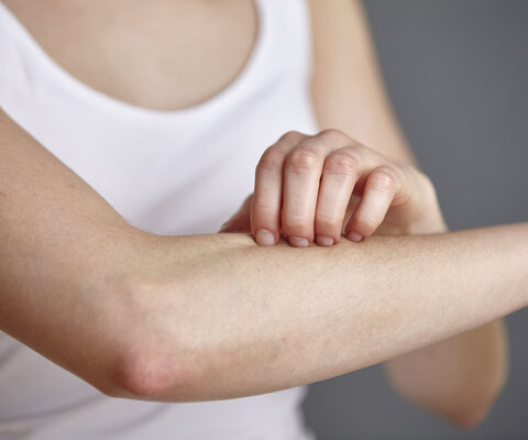 Abgeschnittene Aufnahme einer jungen Frau, die sich mit den Fingern am Unterarm kratzt