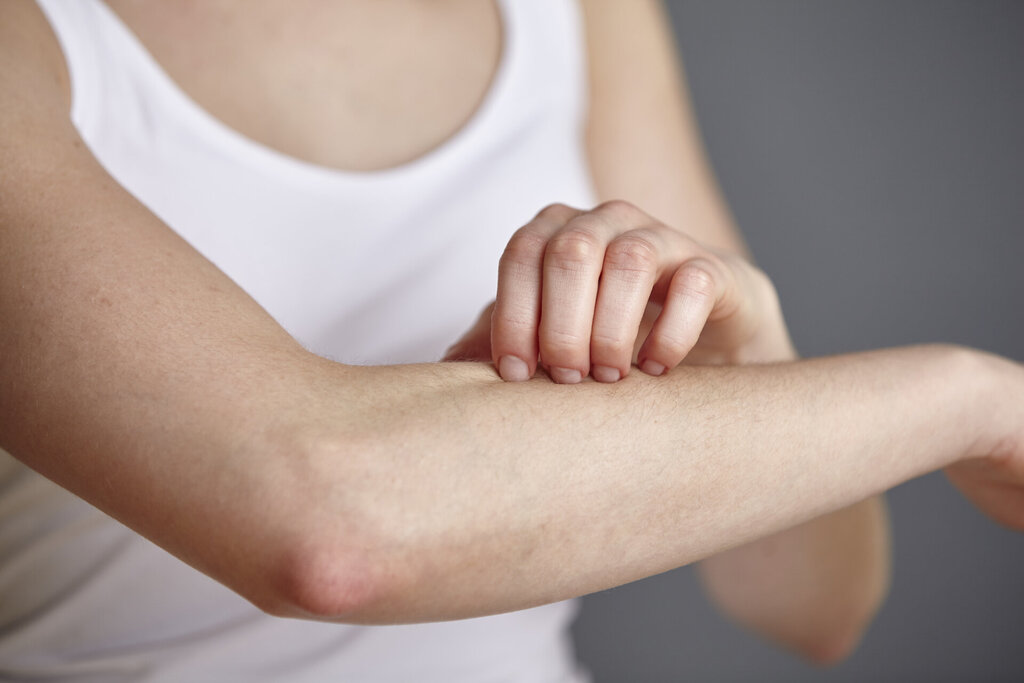 Kontaktallergie (allergisches Kontaktekzem): Ursachen, Symptome &  Behandlung - hkk Magazin