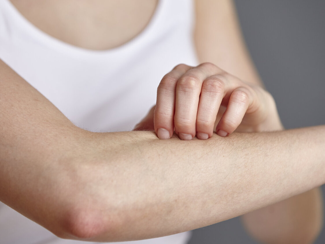 Abgeschnittene Aufnahme einer jungen Frau, die sich mit den Fingern am Unterarm kratzt