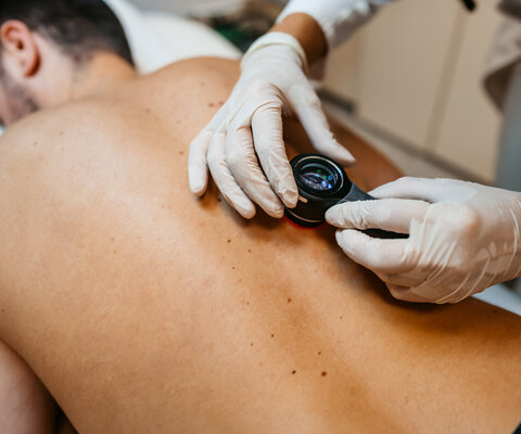 Eine Mann in einer Hautkrebsuntersuchung durch einen Arzt mit Lupe