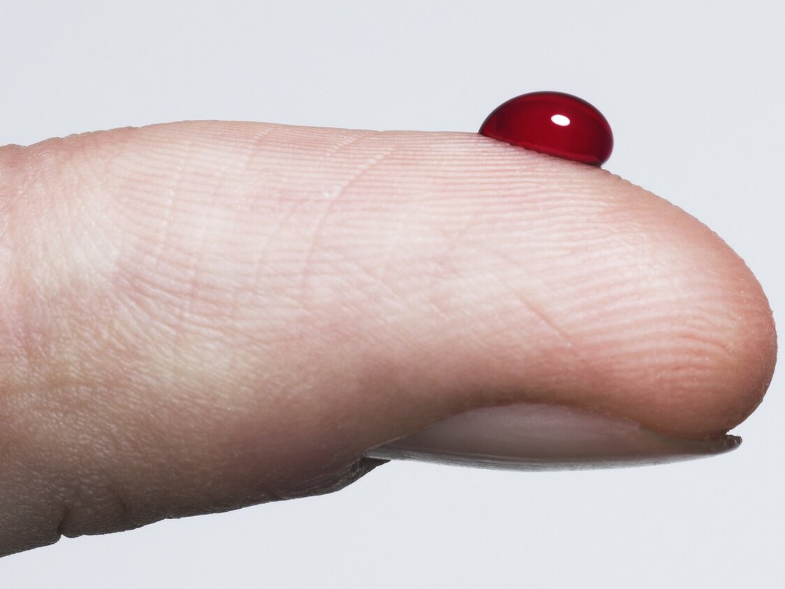 Ist ist die Spitze eines Fingers zu sehen auf der sich ein Bluttropfen gebildet hat.