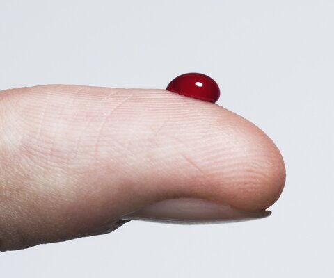 Ist ist die Spitze eines Fingers zu sehen auf der sich ein Bluttropfen gebildet hat.