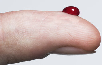Ist ist die Spitze eines Fingers zu sehen auf der sich ein Bluttropfen gebildet hat.