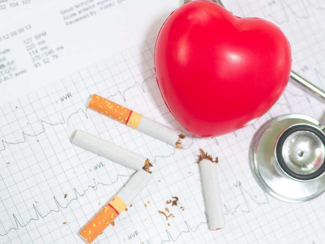 Auf einem ausgedruckten EKG-Diagramm liegen durchgebrochene Zigaretten, ein Herz-Luftballon und ein Stetoskop.